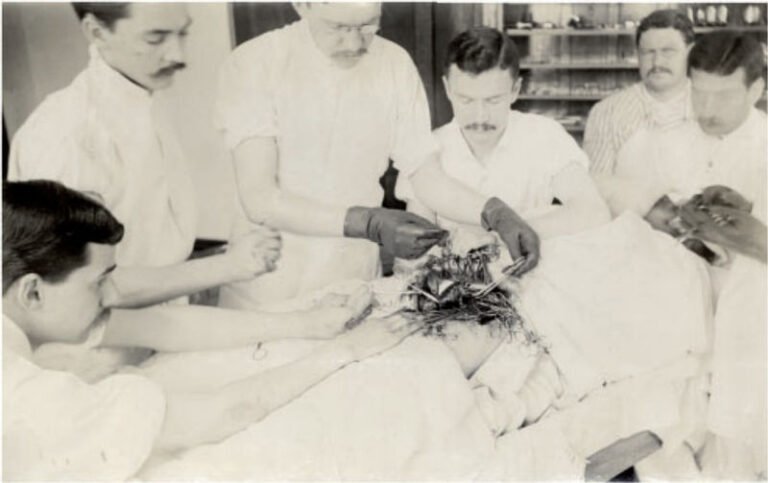 Dulu Dokter Beroperasi dengan Tangan Telanjang, Hingga Halsted Membuat Sarung Tangan untuk Perawatnya